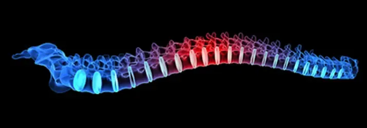 Colored spine illustration with highlighted vertebrae displayed against a black background.